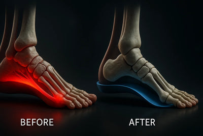 Arch support begins realigning foot